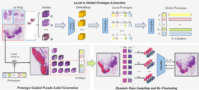 Figure 1 for A Prototype-Guided Coarse Annotations Refining Approach for Whole Slide Images