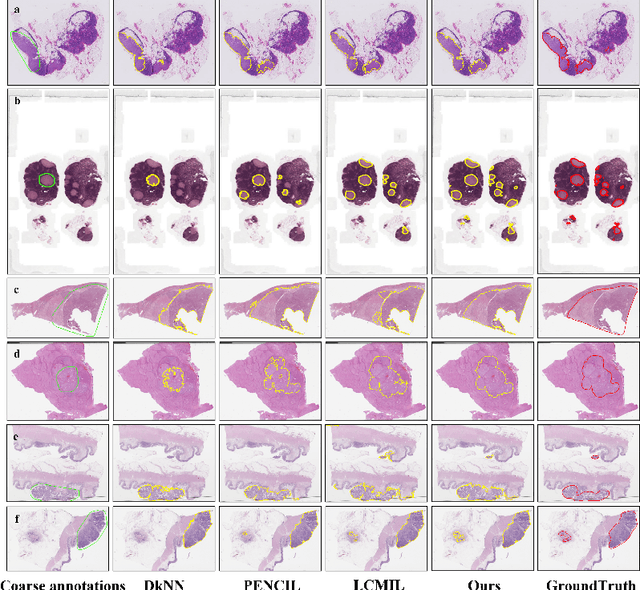 Figure 4 for A Prototype-Guided Coarse Annotations Refining Approach for Whole Slide Images
