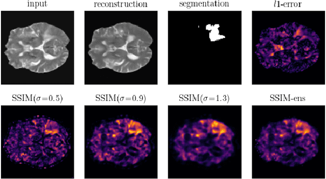 Figure 1 for Diffusion Models with Ensembled Structure-Based Anomaly Scoring for Unsupervised Anomaly Detection