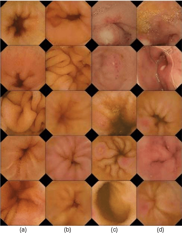 Figure 4 for This Intestine Does Not Exist: Multiscale Residual Variational Autoencoder for Realistic Wireless Capsule Endoscopy Image Generation