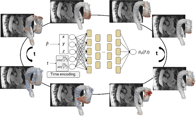 Figure 1 for Neural Fields for Continuous Periodic Motion Estimation in 4D Cardiovascular Imaging