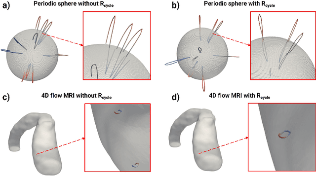 Figure 4 for Neural Fields for Continuous Periodic Motion Estimation in 4D Cardiovascular Imaging