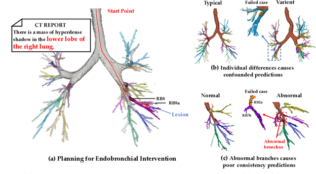 Figure 1 for Airway Labeling Meets Clinical Applications: Reflecting Topology Consistency and Outliers via Learnable Attentions