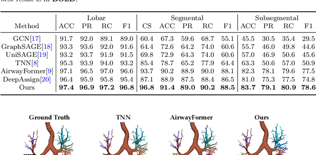 Figure 2 for Airway Labeling Meets Clinical Applications: Reflecting Topology Consistency and Outliers via Learnable Attentions