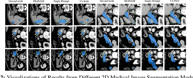 Figure 3 for Multi-Prompt Fine-Tuning of Foundation Models for Enhanced Medical Image Segmentation