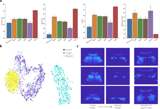 Figure 2 for Training-free image style alignment for self-adapting domain shift on handheld ultrasound devices