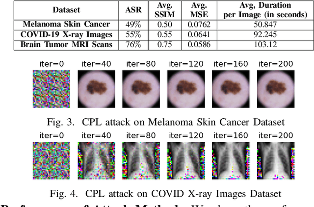 Figure 3 for Privacy Risks Analysis and Mitigation in Federated Learning for Medical Images
