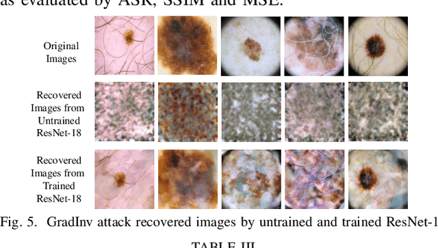 Figure 4 for Privacy Risks Analysis and Mitigation in Federated Learning for Medical Images