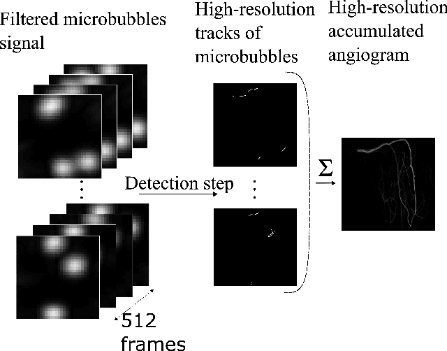 Figure 1 for Pruning Sparse Tensor Neural Networks Enables Deep Learning for 3D Ultrasound Localization Microscopy