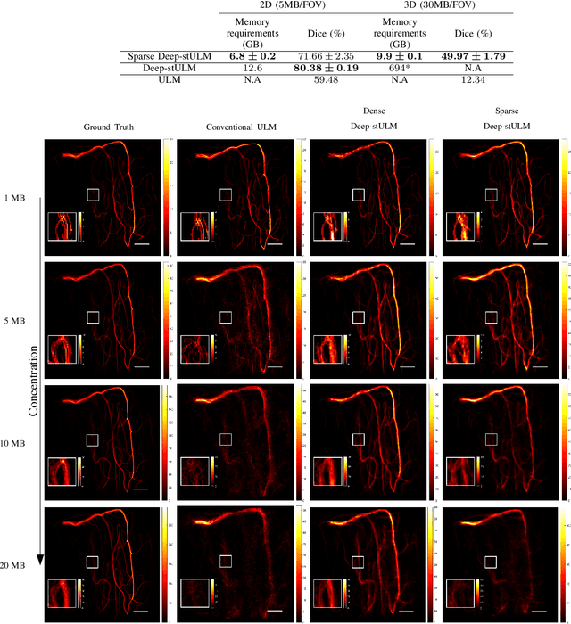 Figure 4 for Pruning Sparse Tensor Neural Networks Enables Deep Learning for 3D Ultrasound Localization Microscopy