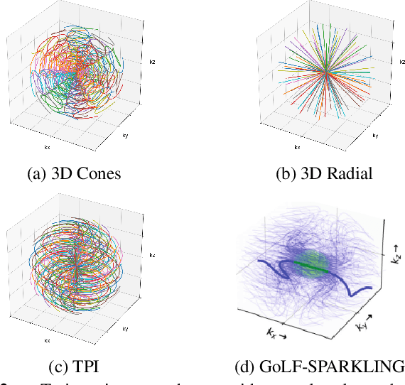 Figure 3 for Benchmarking 3D multi-coil NC-PDNet MRI reconstruction