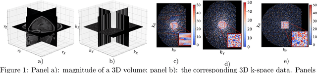 Figure 1 for MotionTTT: 2D Test-Time-Training Motion Estimation for 3D Motion Corrected MRI