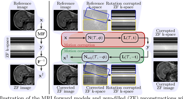 Figure 3 for MotionTTT: 2D Test-Time-Training Motion Estimation for 3D Motion Corrected MRI