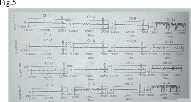 Figure 2 for PiEEG-16 to Measure 16 EEG Channels with Raspberry Pi for Brain-Computer Interfaces and EEG devices