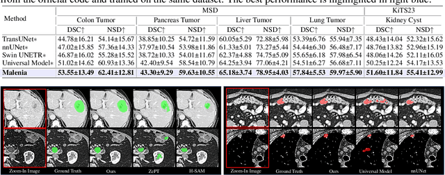 Figure 3 for Unleashing the Potential of Vision-Language Pre-Training for 3D Zero-Shot Lesion Segmentation via Mask-Attribute Alignment