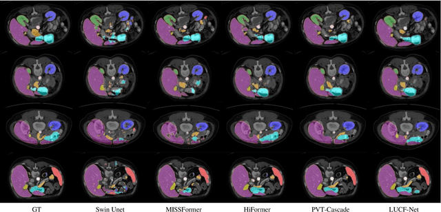 Figure 3 for LUCF-Net: Lightweight U-shaped Cascade Fusion Network for Medical Image Segmentation