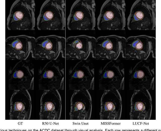 Figure 4 for LUCF-Net: Lightweight U-shaped Cascade Fusion Network for Medical Image Segmentation