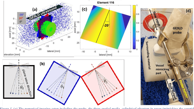 Figure 1 for Simultaneous Coherent and Displacement Compounding for 2D Noninvasive Carotid Strain Imaging: a Proof of Principle Study