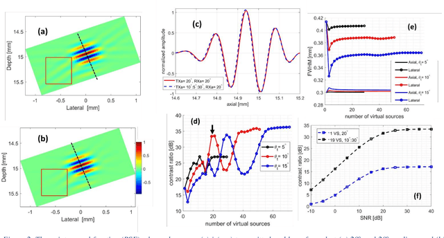 Figure 2 for Simultaneous Coherent and Displacement Compounding for 2D Noninvasive Carotid Strain Imaging: a Proof of Principle Study