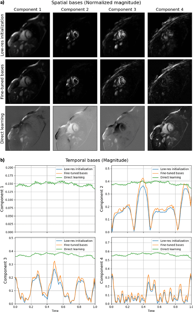 Figure 4 for Subspace Implicit Neural Representations for Real-Time Cardiac Cine MR Imaging