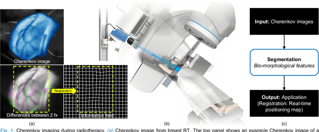 Figure 1 for Robust Real-time Segmentation of Bio-Morphological Features in Human Cherenkov Imaging during Radiotherapy via Deep Learning