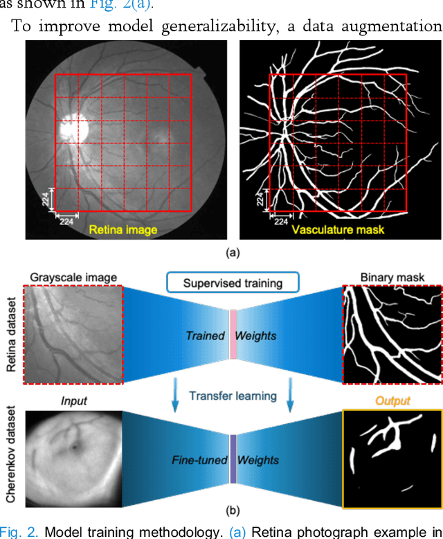 Figure 3 for Robust Real-time Segmentation of Bio-Morphological Features in Human Cherenkov Imaging during Radiotherapy via Deep Learning