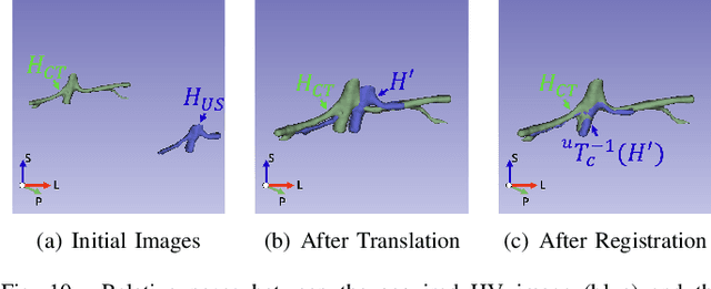 Figure 2 for Autonomous Robotic Ultrasound System for Liver Follow-up Diagnosis: Pilot Phantom Study