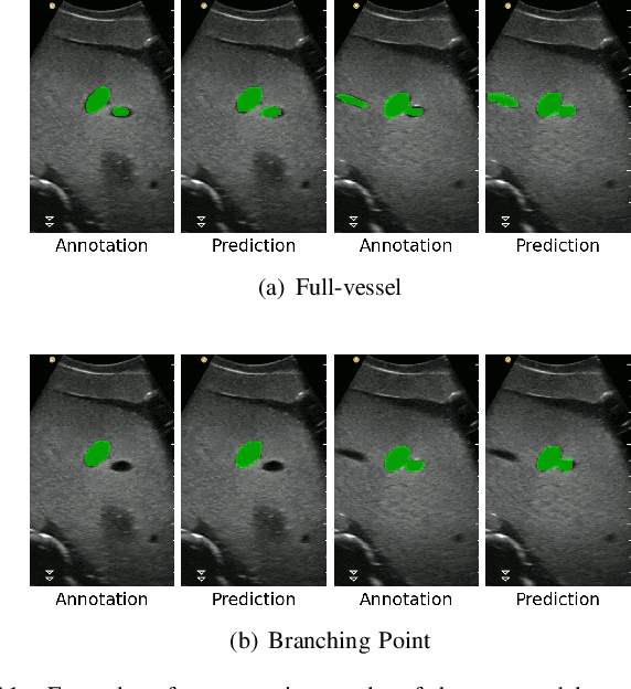 Figure 3 for Autonomous Robotic Ultrasound System for Liver Follow-up Diagnosis: Pilot Phantom Study