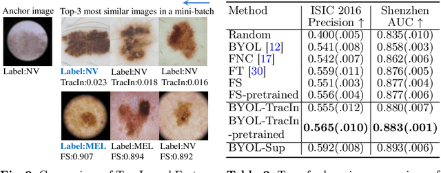 Figure 3 for Additional Positive Enables Better Representation Learning for Medical Images