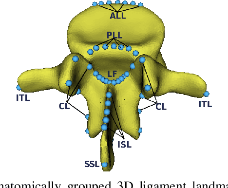 Figure 1 for Spinal ligaments detection on vertebrae meshes using registration and 3D edge detection