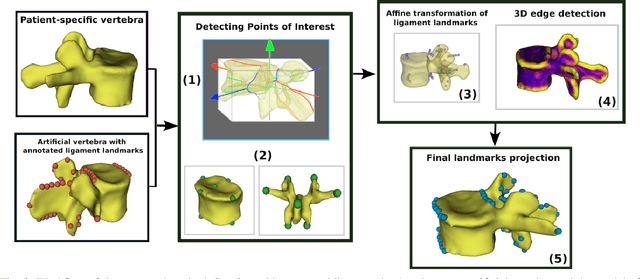 Figure 2 for Spinal ligaments detection on vertebrae meshes using registration and 3D edge detection