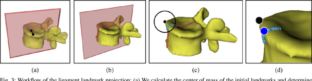 Figure 3 for Spinal ligaments detection on vertebrae meshes using registration and 3D edge detection