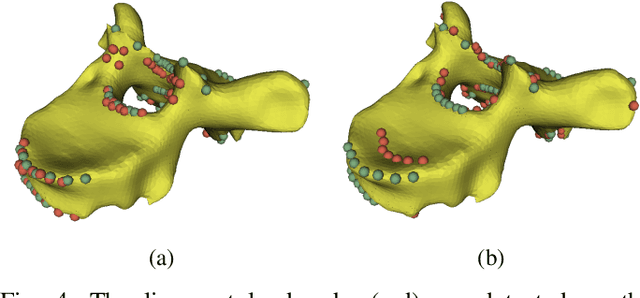 Figure 4 for Spinal ligaments detection on vertebrae meshes using registration and 3D edge detection