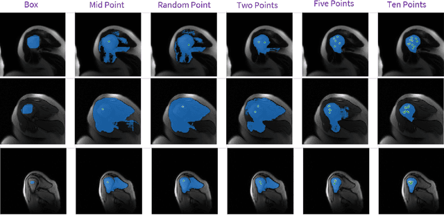 Figure 4 for Data Adaptive Few-shot Multi Label Segmentation with Foundation Model