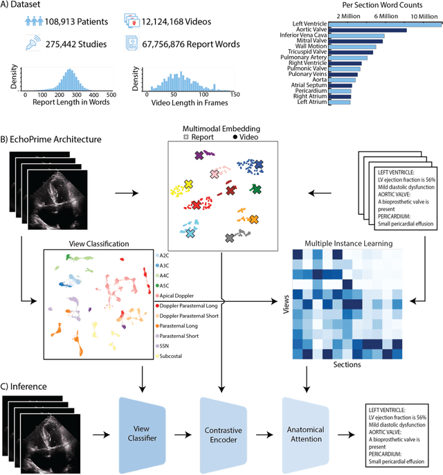 Figure 2 for EchoPrime: A Multi-Video View-Informed Vision-Language Model for Comprehensive Echocardiography Interpretation