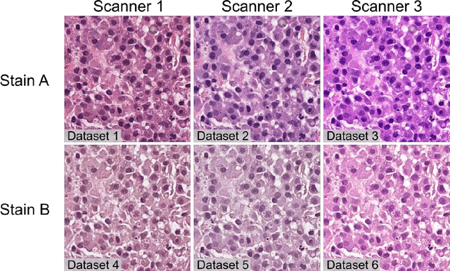 Figure 2 for Deep Learning model predicts the c-Kit-11 mutational status of canine cutaneous mast cell tumors by HE stained histological slides