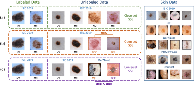 Figure 1 for Towards Open-Scenario Semi-supervised Medical Image Classification