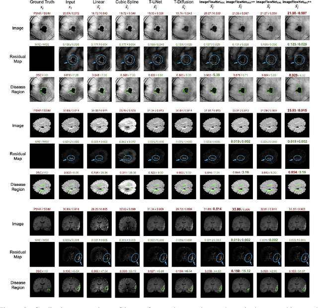 Figure 4 for ImageFlowNet: Forecasting Multiscale Trajectories of Disease Progression with Irregularly-Sampled Longitudinal Medical Images