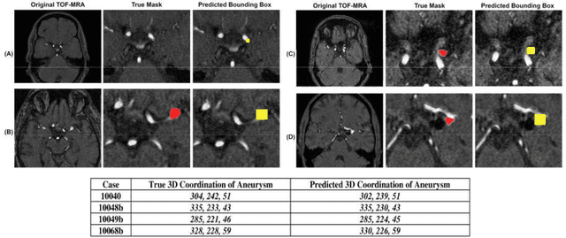 Figure 4 for nnDetection for Intracranial Aneurysms Detection and Localization