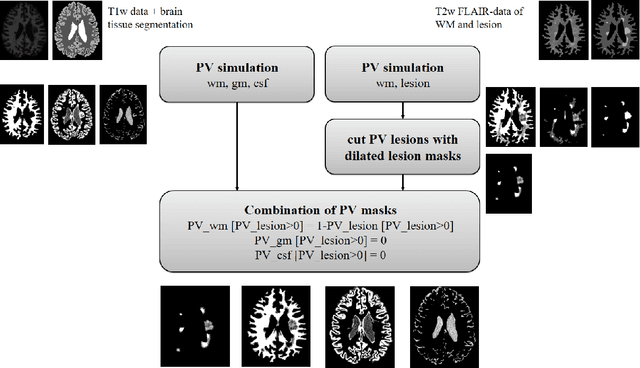 Figure 3 for Simulation of acquisition shifts in T2 Flair MR images to stress test AI segmentation networks