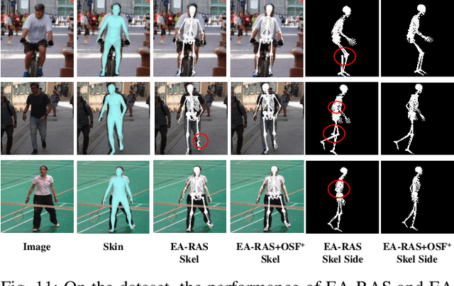 Figure 3 for EA-RAS: Towards Efficient and Accurate End-to-End Reconstruction of Anatomical Skeleton