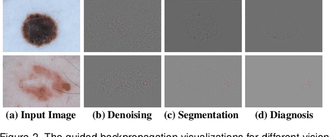 Figure 3 for Generalized Task-Driven Medical Image Quality Enhancement with Gradient Promotion