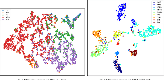 Figure 2 for ECGMamba: Towards Efficient ECG Classification with BiSSM