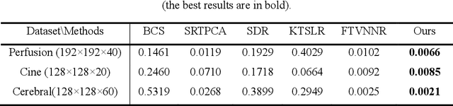Figure 3 for Robust Depth Linear Error Decomposition with Double Total Variation and Nuclear Norm for Dynamic MRI Reconstruction