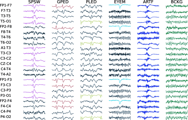 Figure 3 for Nested Deep Learning Model Towards A Foundation Model for Brain Signal Data