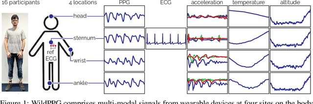 Figure 1 for WildPPG: A Real-World PPG Dataset of Long Continuous Recordings