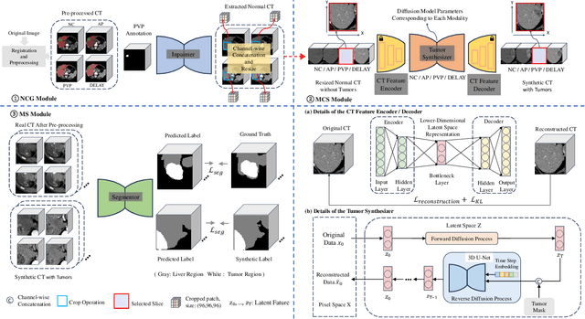 Figure 1 for Diff4MMLiTS: Advanced Multimodal Liver Tumor Segmentation via Diffusion-Based Image Synthesis and Alignment