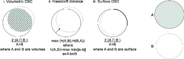 Figure 4 for Deep Learning for Vascular Segmentation and Applications in Phase Contrast Tomography Imaging