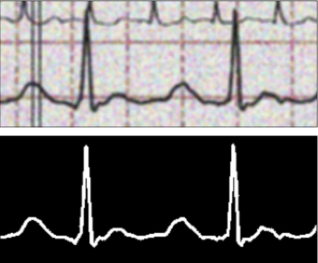 Figure 3 for Deep Learning-Based Digitization of Overlapping ECG Images with Open-Source Python Code