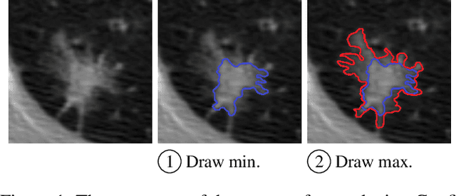 Figure 1 for Confidence Contours: Uncertainty-Aware Annotation for Medical Semantic Segmentation